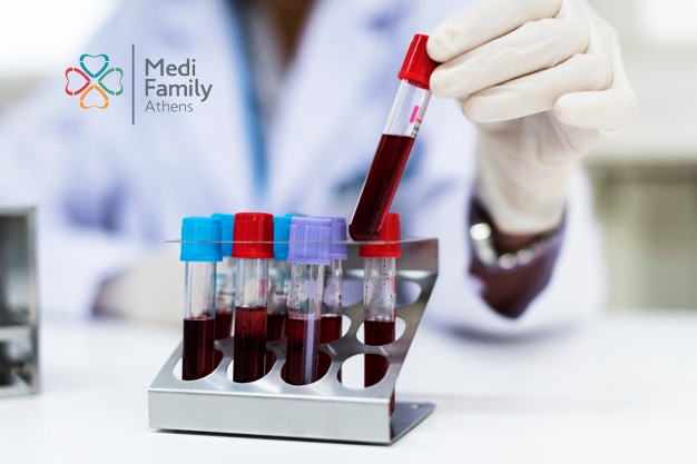 doctor-checking-blood-samples_53876-71644
